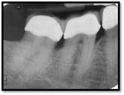 Cs3 Pretx4 Fo Cs3 Pretx4 Fo