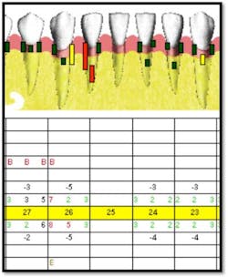 Cs3 Pretx5 Fo Cs3 Pretx5 Fo