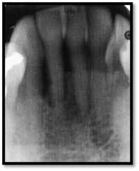 Cs3 Pretx6 Fo Cs3 Pretx6 Fo