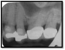 Cs3 Pretx8 Fo Cs3 Pretx8 Fo