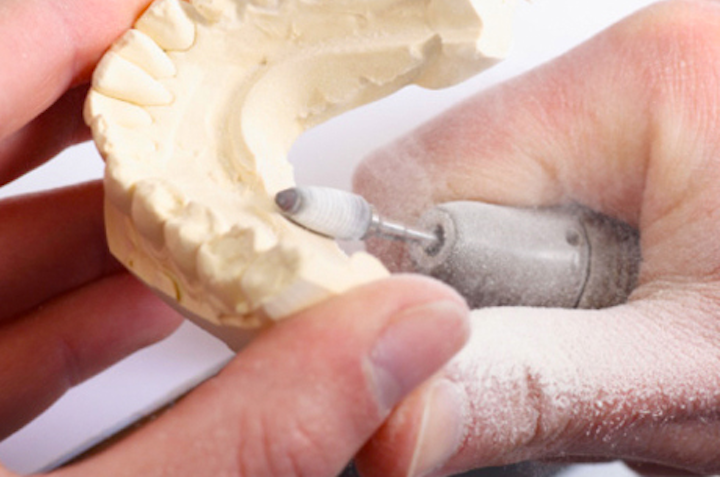 Dental Lab Marketing