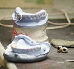 Dental Lab Pickett Dental Lab Pickett