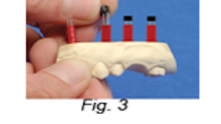 Dental Lab Pickett 1