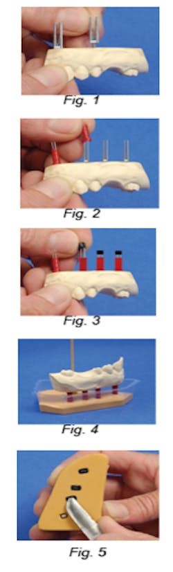 Dental Lab Pickett 1 Dental Lab Pickett 1