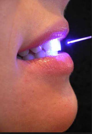 Dental Laser