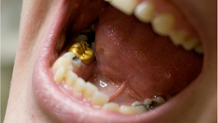 Dental Office Waste