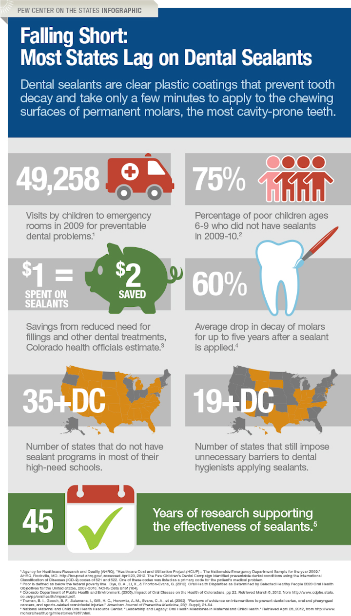 Dental Sealant Infographic
