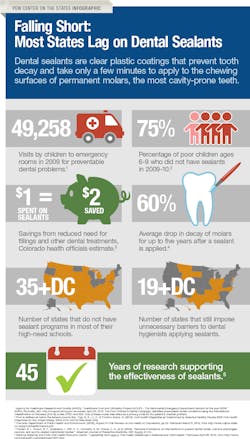 Dental Sealant Infographic Dental Sealant Infographic