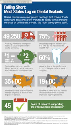 Dental Sealant Infographic Dental Sealant Infographic