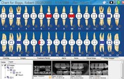 Dentimax Image Charting Scr