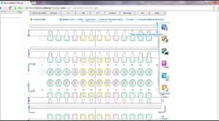 Dentisoft Symphony Es