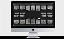 Dexis Dexis Mac Es Dexis Dexis Mac Es