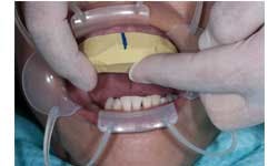 Ditolla 07 Sm Ditolla 07 Sm