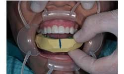 Ditolla 08 Sm Ditolla 08 Sm