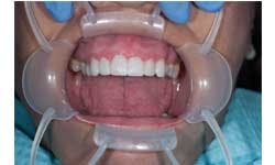 Ditolla 09 Sm Ditolla 09 Sm