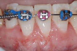 Doobrowfig2 Doobrowfig2