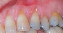 Doobrowfig3 Doobrowfig3