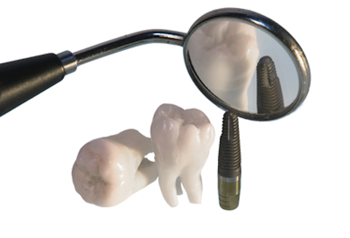 Dreamstime 10340640 Implants2