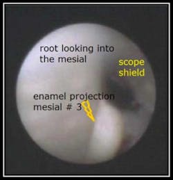 Enamel Pearl Fo Enamel Pearl Fo