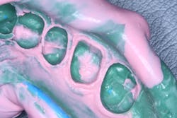 Exa Lence1 Exa Lence1