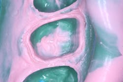 Exa Lence2 Exa Lence2