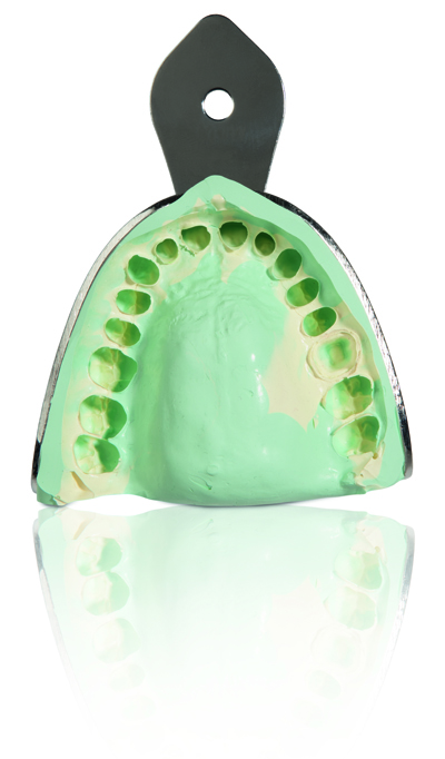 Heraeus Kulzer launches time-saving impression material | DentistryIQ