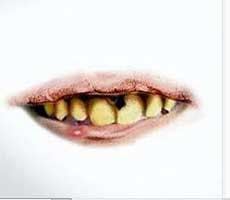 German Fraud German Fraud