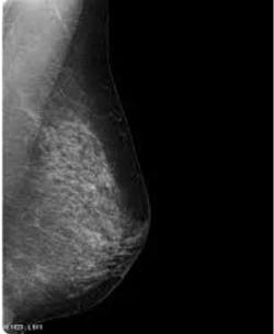 Goldie Mam 2 Goldie Mam 2