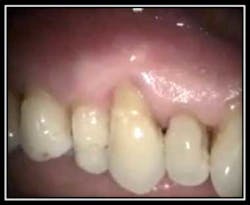 Healthy Resorption 10 Healthy Resorption 10