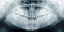 Human Jaw Radiograph