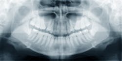 Human Jaw Radiograph Human Jaw Radiograph