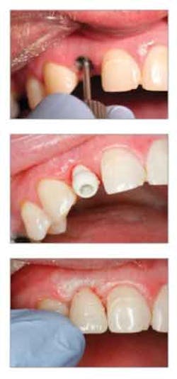 Ids Anywhere Es Ids Anywhere Es