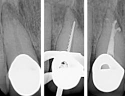 In The Know On Endo In The Know On Endo