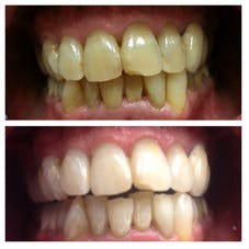 Jan14sadrikorfig7 Jan14sadrikorfig7