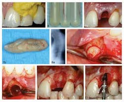 Joicasestudy1april302014 Joicasestudy1april302014