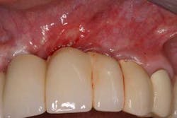 June2012froum02 June2012froum02