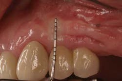 June2012froum03c June2012froum03c