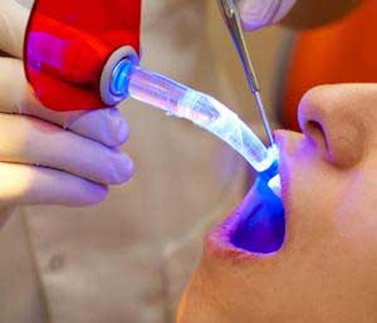 Clinical application of lasers in dental hygiene DentistryIQ