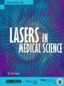 Lasers Cover Fo Lasers Cover Fo