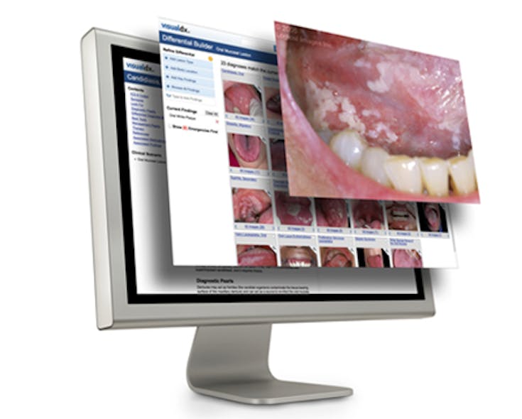 Lexicomp