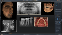 Lightbox Sirona Sidexis4 Lightbox Sirona Sidexis4