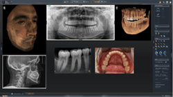 Lightbox Sirona Sidexis4 Lightbox Sirona Sidexis4