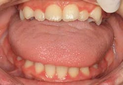 Maisonet8weekspostxylitol Maisonet8weekspostxylitol