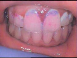 Maisonetplaqueidgel Maisonetplaqueidgel