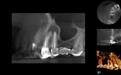 Mccormack Nonsurgical Endo Cbct Mccormack Nonsurgical Endo Cbct