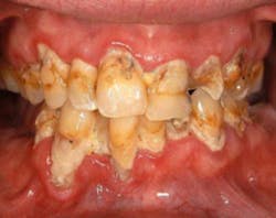 Methmouth Methmouth