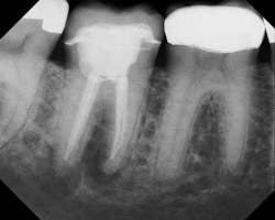 Mounceendoretreatpreopmay2013 Mounceendoretreatpreopmay2013