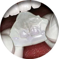 Nitebite Es Nitebite Es