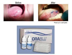 Orablu Kit Es Orablu Kit Es