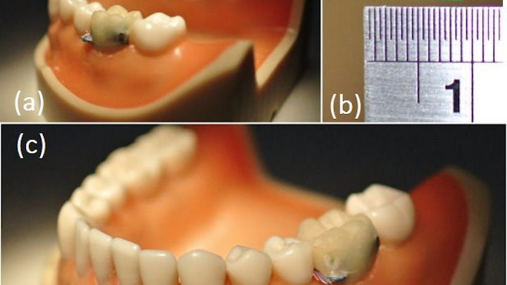 Oralsensor